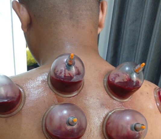 Layanan Bekam Tradisional Buka di Bantul Bapak Nugroho Terima Panggilan Rumah untuk Pengobatan Tradisional